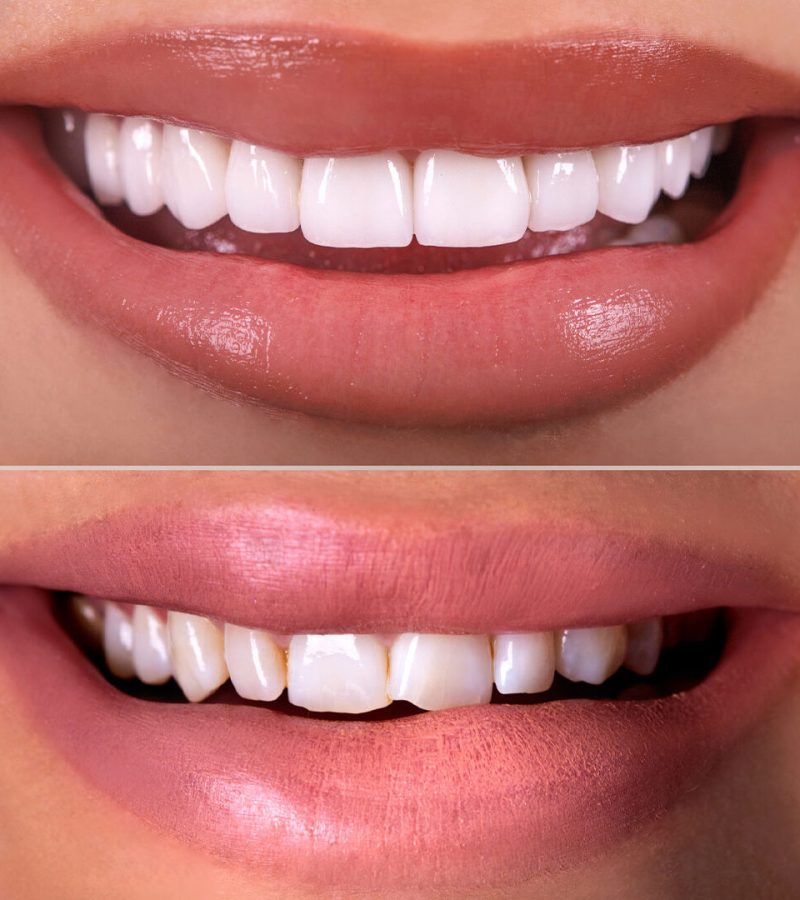 zahnrestauration_tridentmedical-e1729499120354